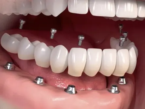Clínica Dental Del Estrecho, salud con descuento